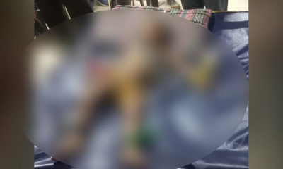 রাউজানে গভীর নলকূপ থেকে উদ্ধার শিশুটি মারা গেছে