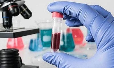 কারাগারগুলোতে ডোপ টেস্ট শুরু শনাক্ত ৮